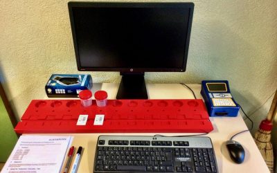 Interne Drogentests